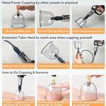 TEMU cupping and relaxation kit with vacuum cups and manual pump, used for massage and muscle relief.