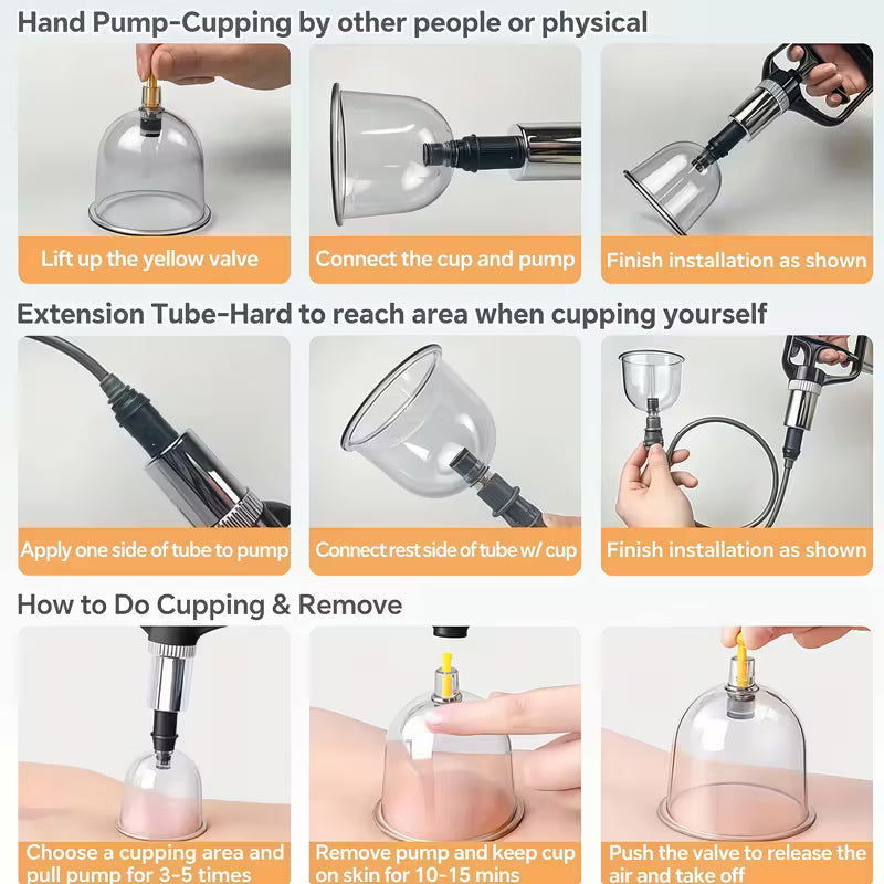 TEMU cupping and relaxation kit with vacuum cups and manual pump, used for massage and muscle relief.