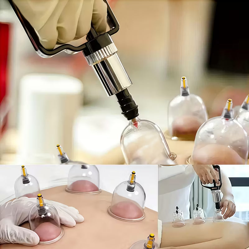 TEMU cupping and relaxation kit with vacuum cups and manual pump, used for massage and muscle relief.