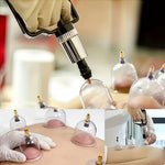 TEMU cupping and relaxation kit with vacuum cups and manual pump, used for massage and muscle relief.