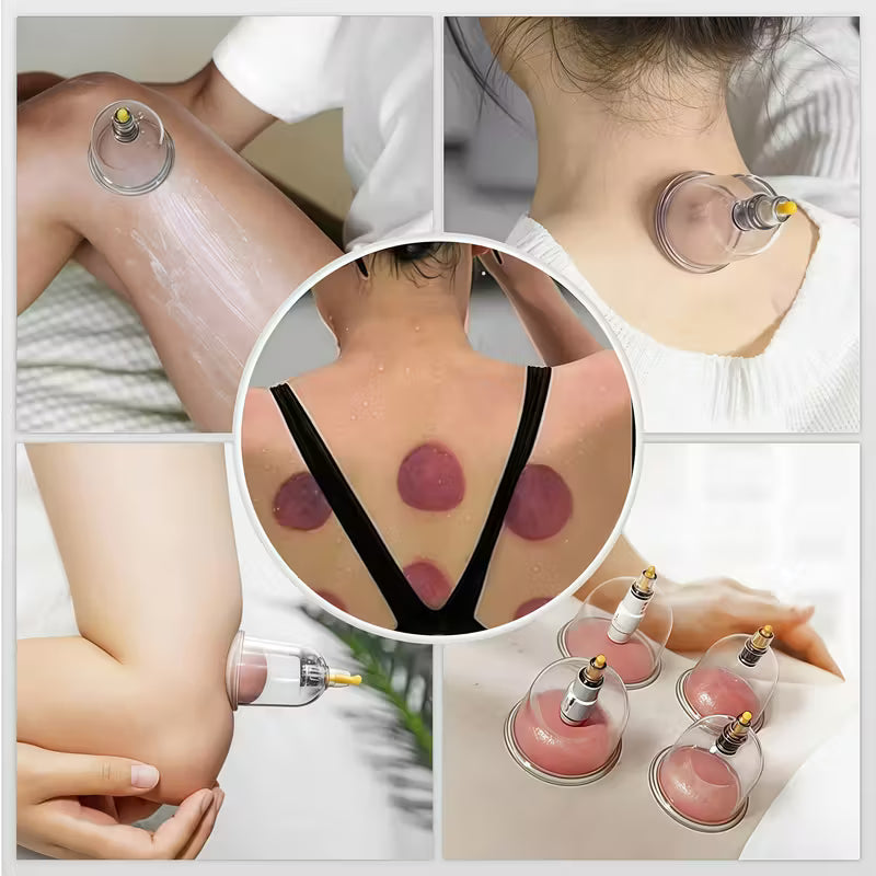 TEMU cupping and relaxation kit with vacuum cups and manual pump, designed for muscle relief and relaxation therapy.